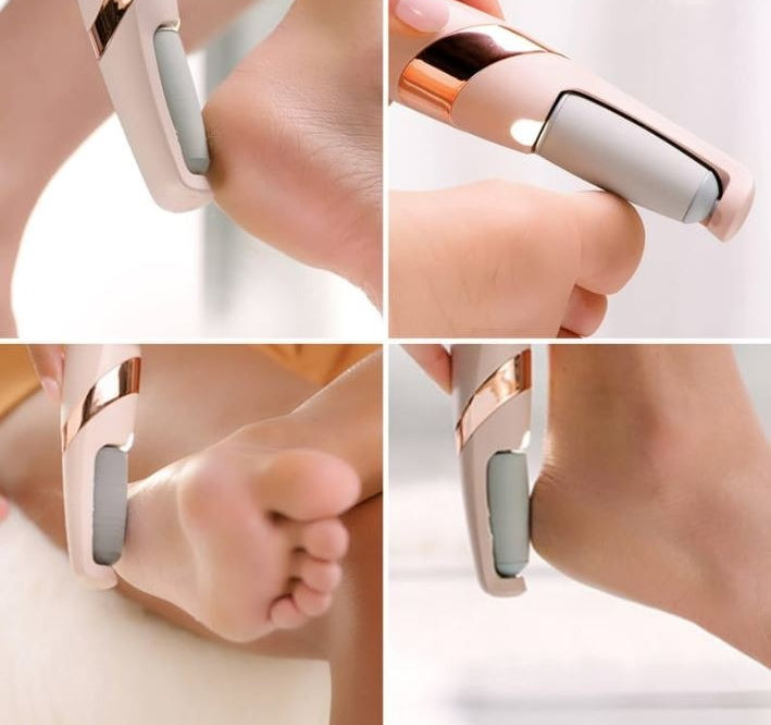 Foot Callus Remover