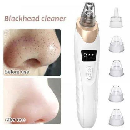 Electric Blackhead Remover Vacuum | Deep Pore Cleaner