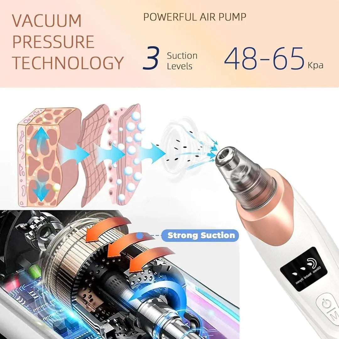 Electric Blackhead Remover Vacuum | Deep Pore Cleaner