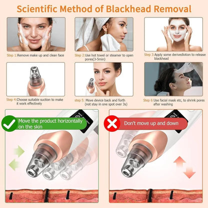 Electric Blackhead Remover Vacuum | Deep Pore Cleaner
