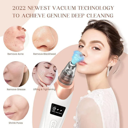 Electric Blackhead Remover Vacuum | Deep Pore Cleaner