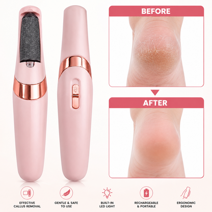 Foot Callus Remover