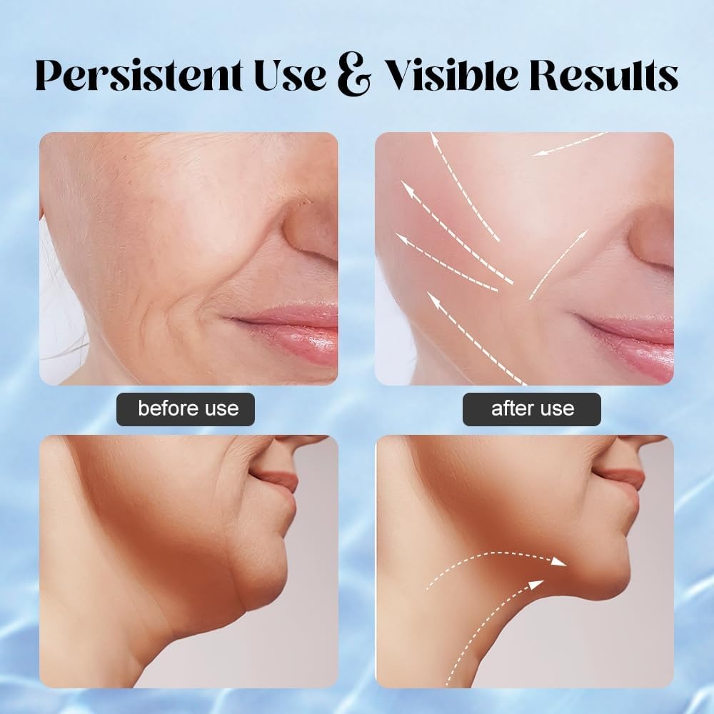 5-in-1 Neck & Face Lift Massager